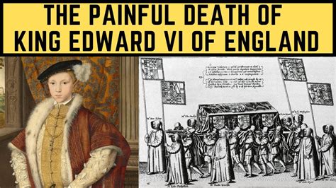 king edward vi illnesses.